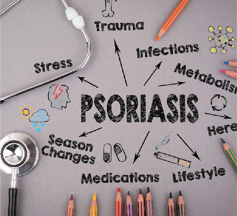 Psoriasis treatment in ayurveda