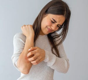herbal treatment for skin allergy