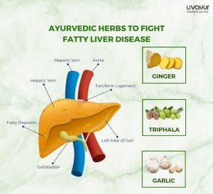 Fight Fatty Liver Disease With 5 Ayurvedic Herbs 1