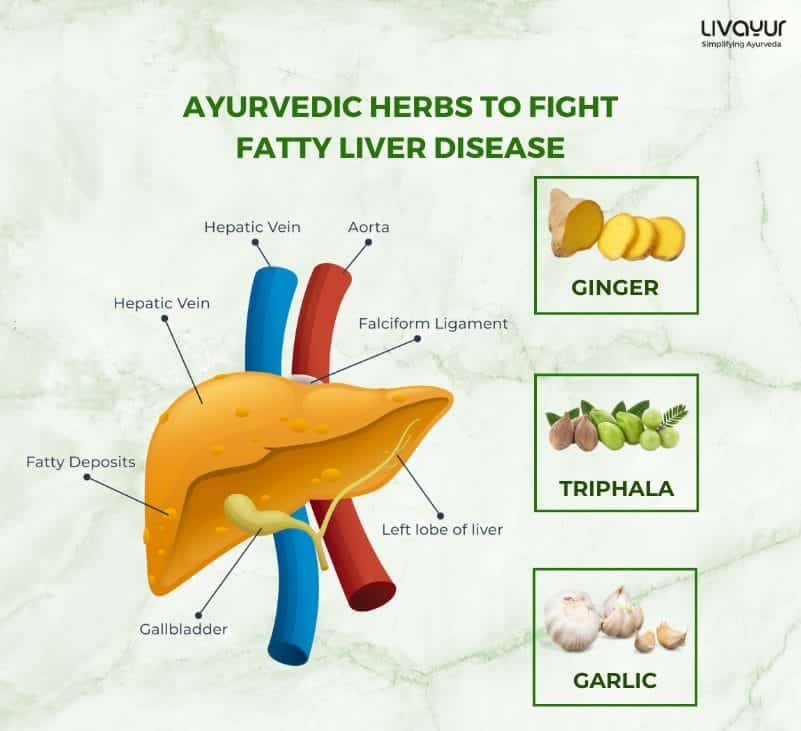 Fight Fatty Liver Disease With 5 Ayurvedic Herbs 1
