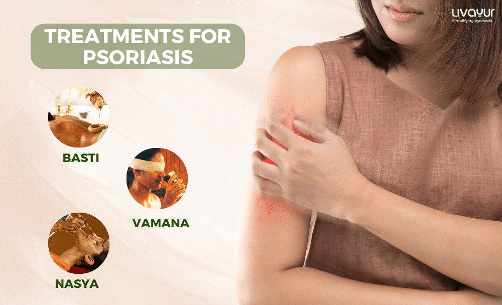 Psoriasis and Ayurvedic Treatment Does it Work 1