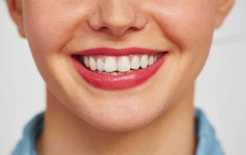 Natural teeth whitening remedies