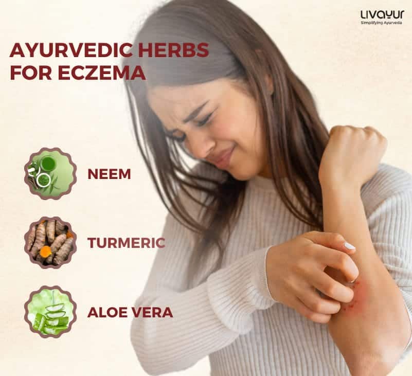 Ayurvedic Treatment of Eczema Tips and More 1