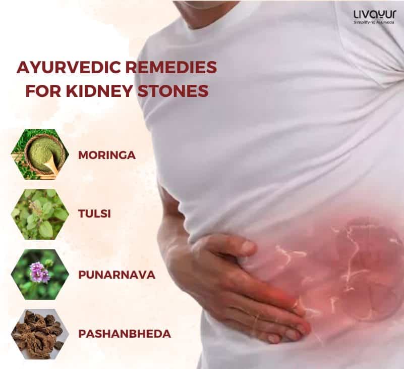 Ayurvedic Remedies Backed By Science for Effective Relief from Kidney Stones 1