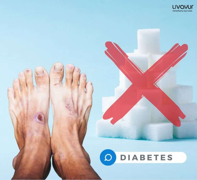 Foot Ulcers Diabetes