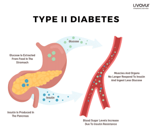 Type 2 Diabetes