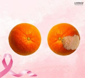 Breast Cancer