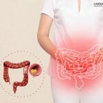 Colorectal Cancer 1