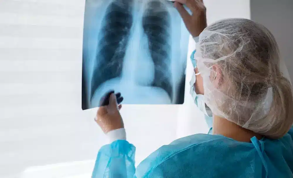 lung cancer - livayur