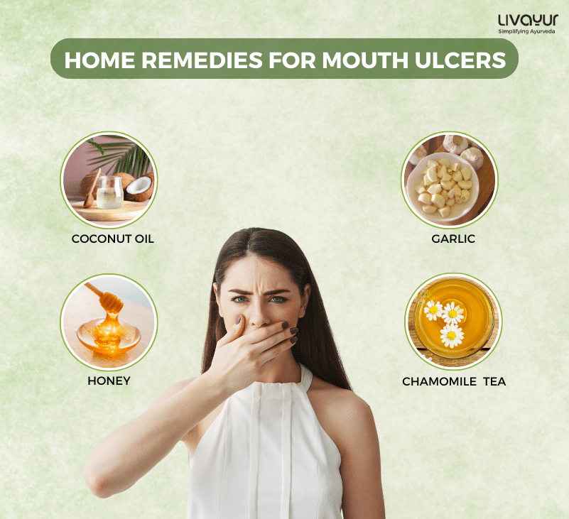 15 Best Home Remedies to Cure Mouth Ulcers Fast 1 1