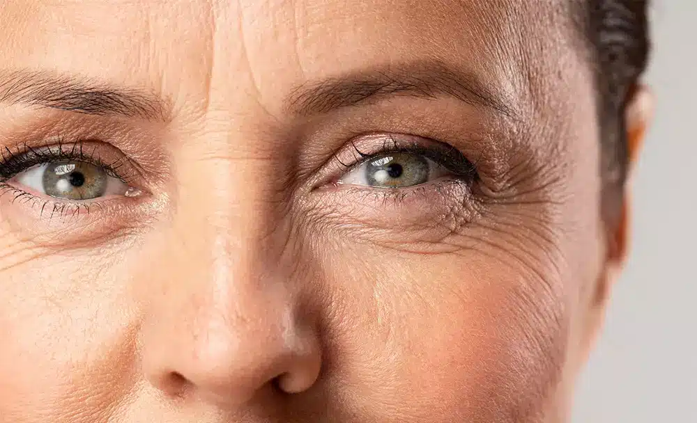 wrinkles - livayur