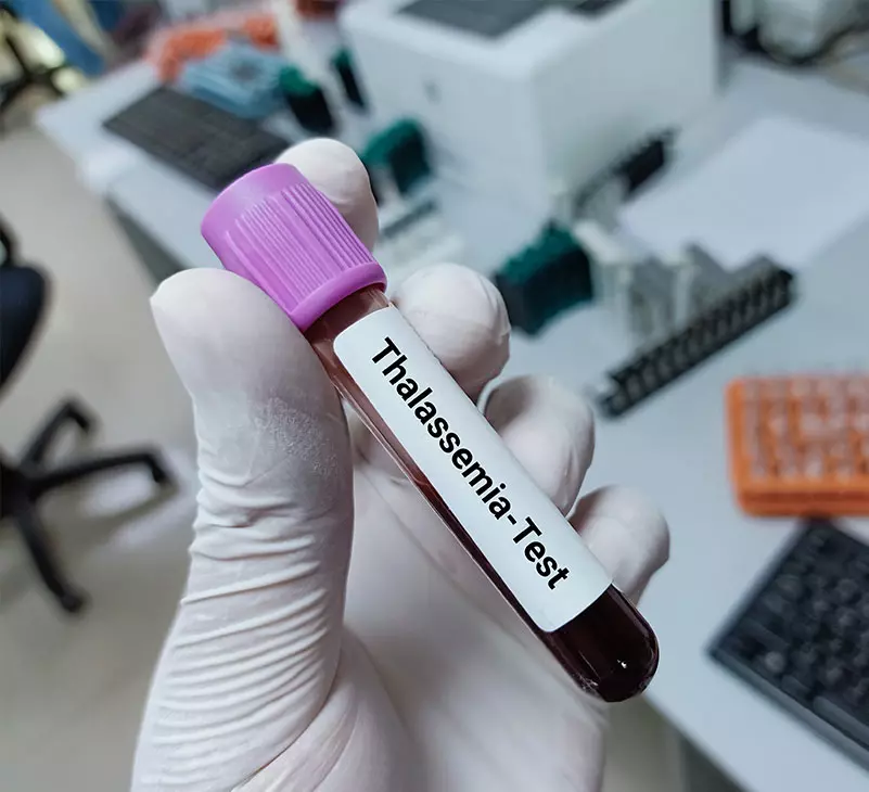 what is thalassemia - livayur