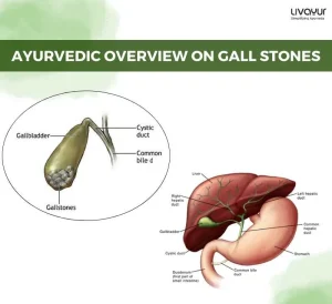 Gallstones Symptoms Causes Diagnosis Treatment More 3 11zon