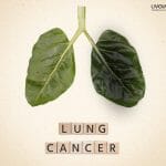 Lung Cancer 1