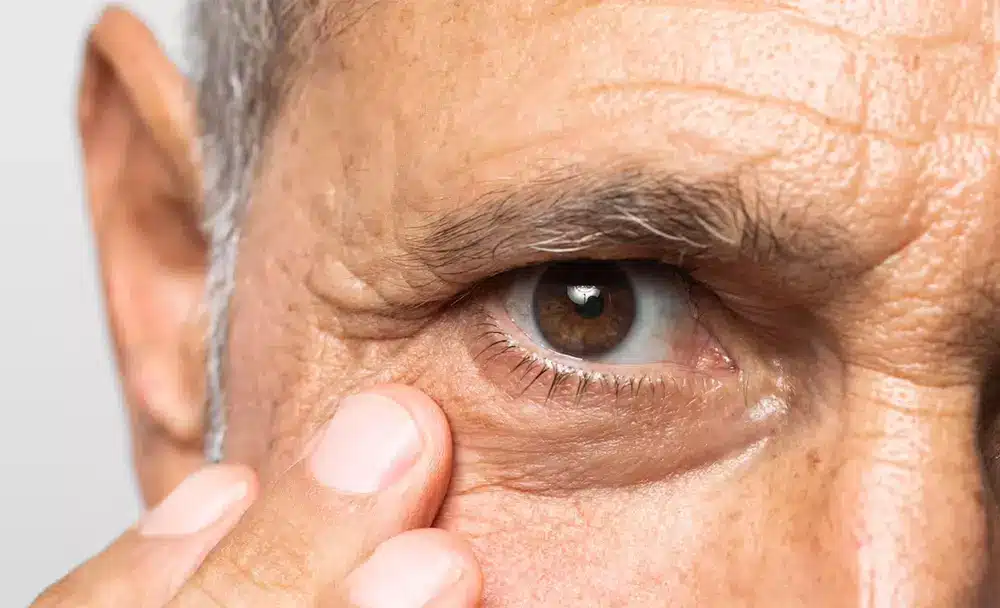 cataract symptoms