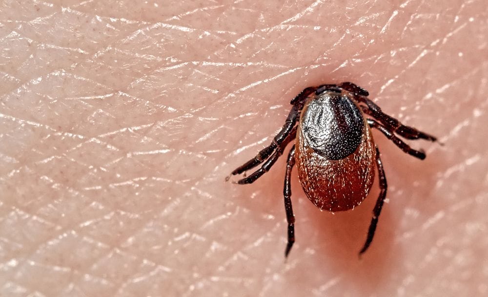 lyme disease - livayur