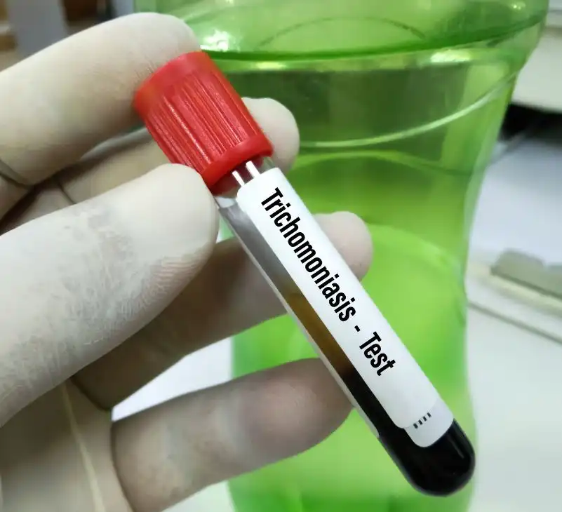 trichomoniasis - livayur