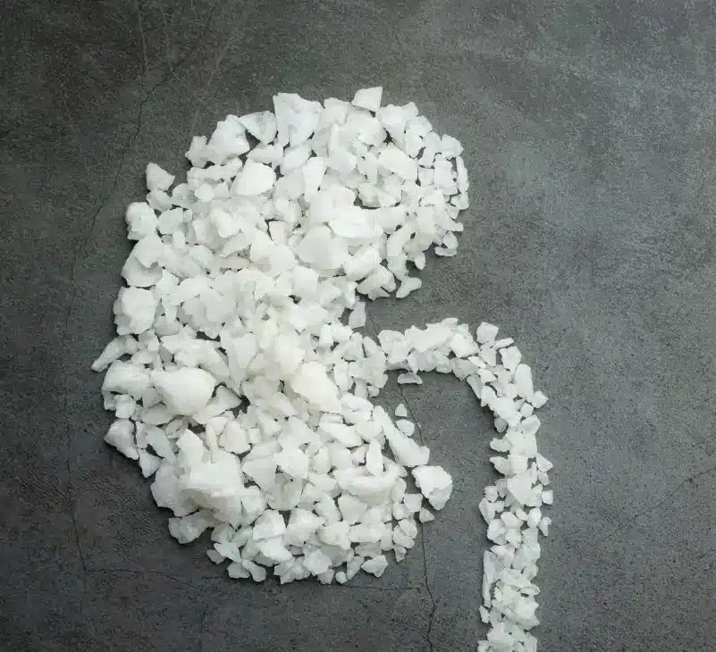 kidney stone symptoms - livayur