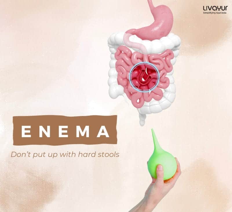 Enema What is it Benefits Uses Procedure Side Effects 3