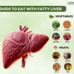 Fatty Liver Diet What Food to Eat Avoid 3 12 11zon