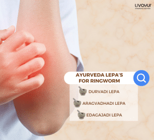 Ringworm What is it Symptoms Causes Treatment Precautions THUMBNAIL