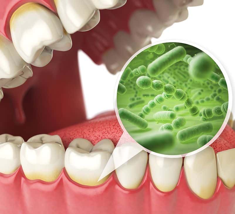 mouth infection - livayur