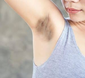 dark underarms - livayur
