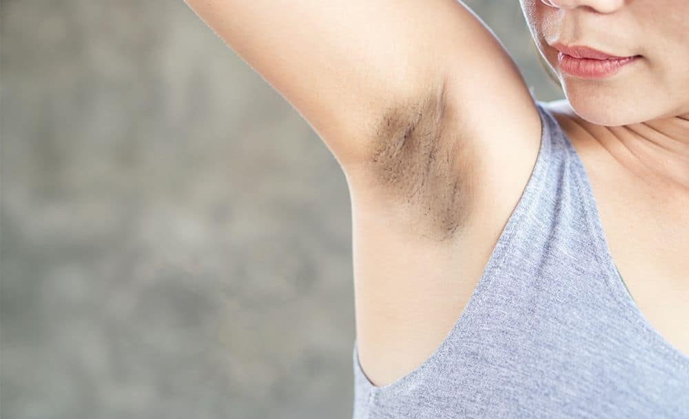 dark underarms - livayur