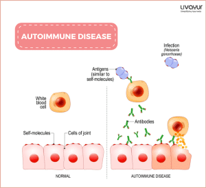 Autoimmune Disease Causes Symptoms Types Treatment More 1