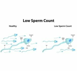 oligospermia - livayur