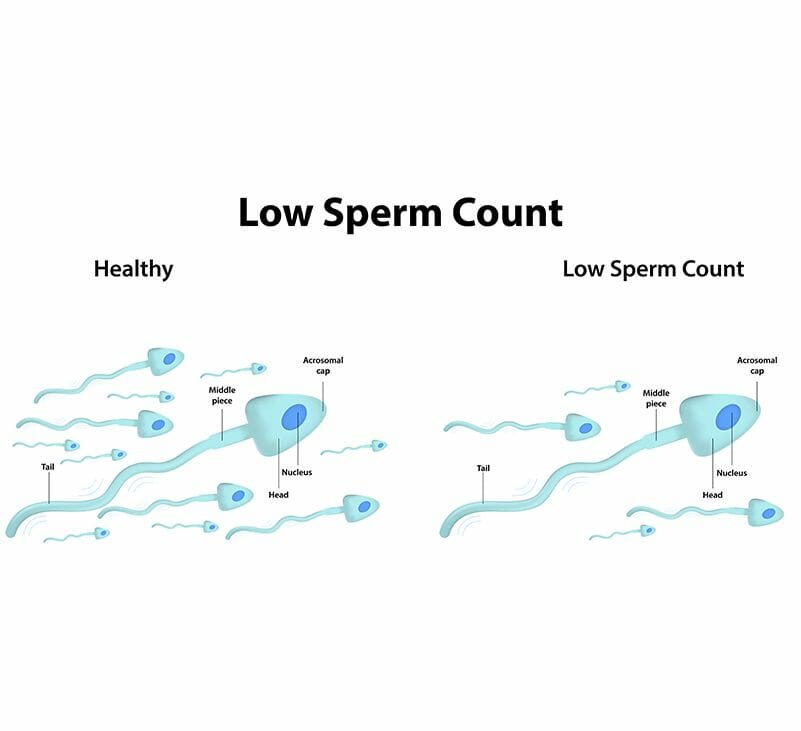 oligospermia - livayur