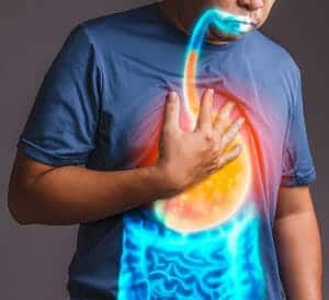 gastroesophageal reflux disease