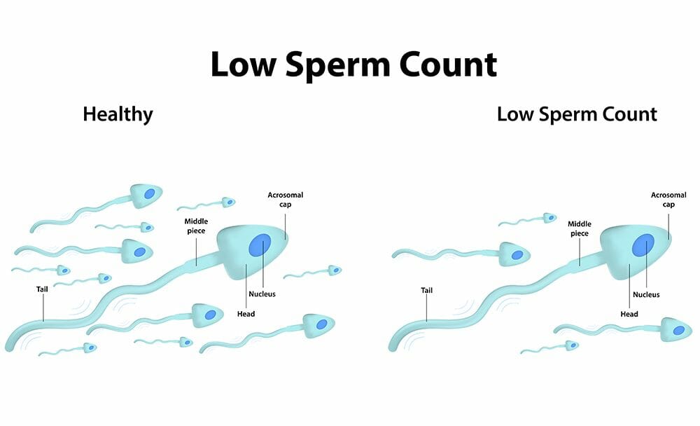 oligospermia - livayur