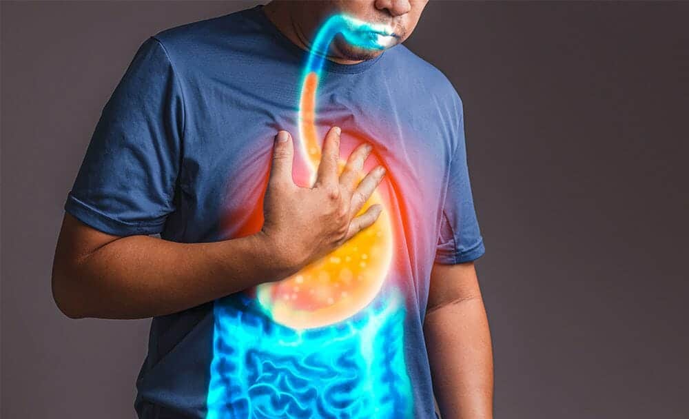 gastroesophageal reflux disease