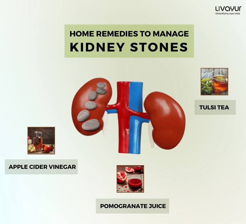 home remedies for kidney stones