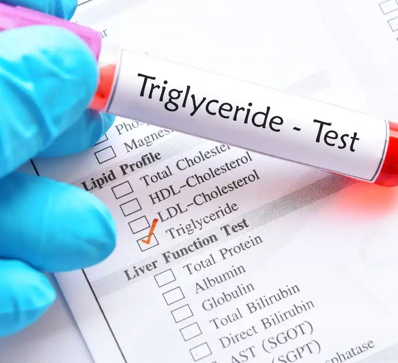 High Triglycerides Causes