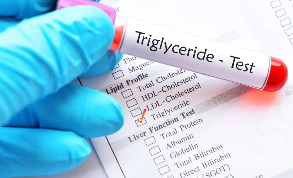 High Triglycerides Causes