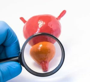 foods to avoid with enlarged prostate