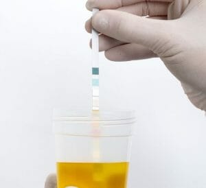 uric acid food to avoid