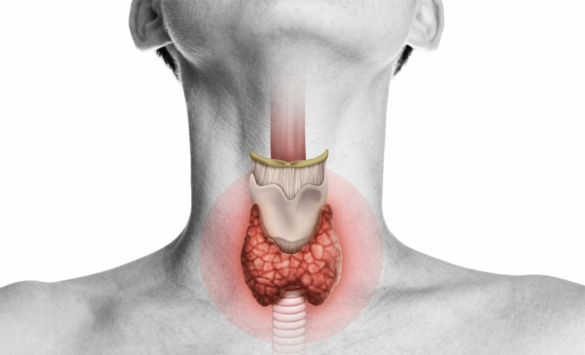 causes of thyroid in female in hindi