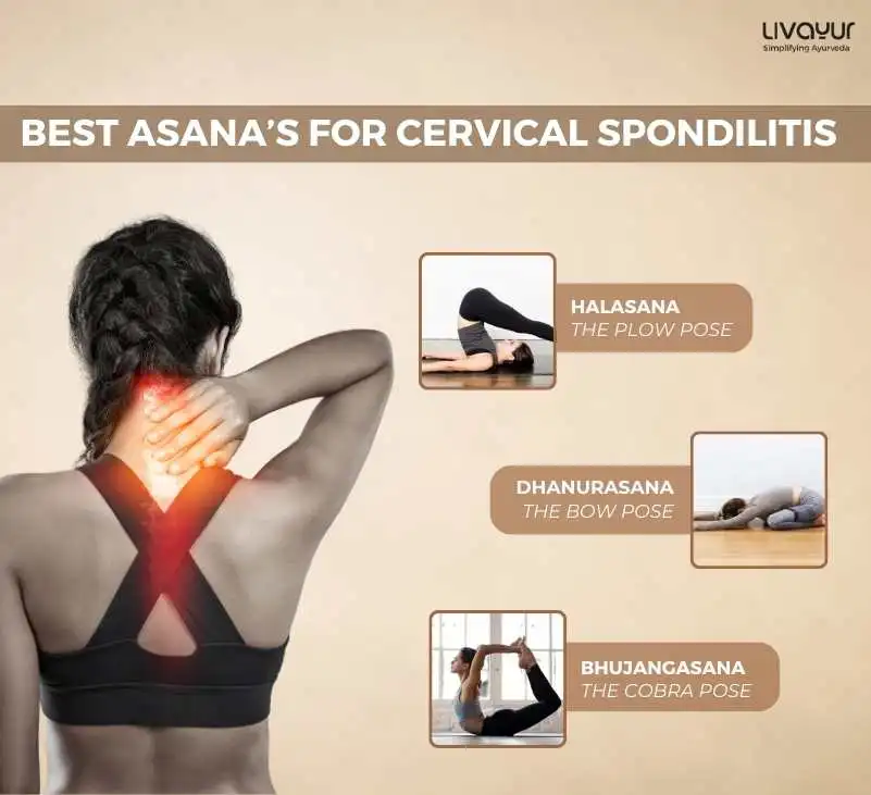 10 Best Exercises to Relieve cervical spondylosis 1