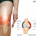 Ayurvedic Medicines Treatments and Remedies for Joint Pain 2