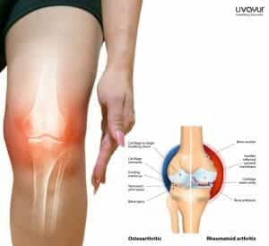 Ayurvedic Medicines Treatments and Remedies for Joint Pain 2