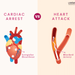 Cardiac Arrest What is Cardiac Arrest Causes Symptoms Treatment Prevention