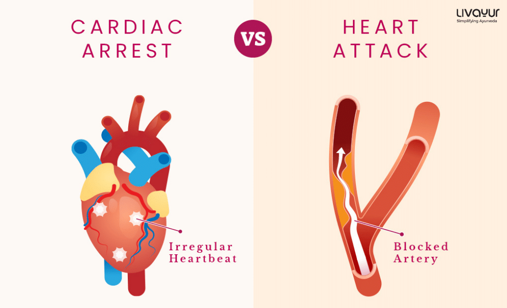 Cardiac Arrest What is Cardiac Arrest Causes Symptoms Treatment Prevention 2