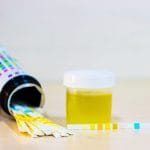 Symptoms of Glycosuria
