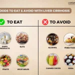 Liver Cirrhosis Diet Foods to eat and avoid with Liver Cirrhosis 1 18 11zon