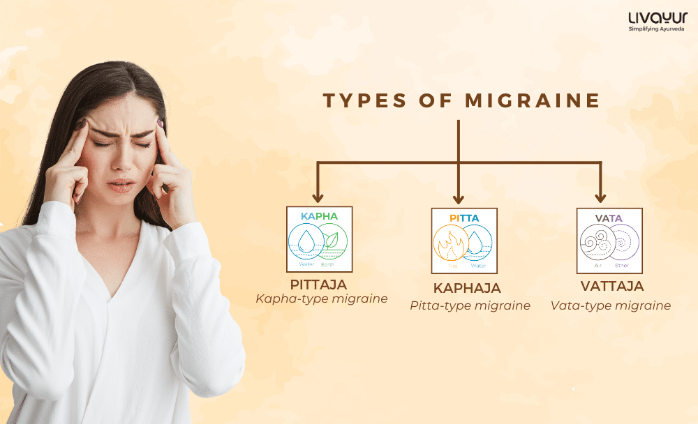 migraine treatment in ayurveda