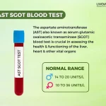 ast sgot normal range