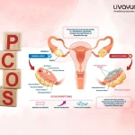 what size of ovarian cyst is dangerous